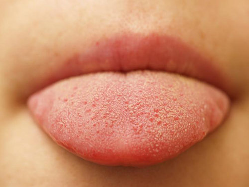 Surface of a human tongue