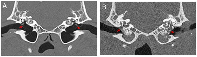 AI can be deployed to diagnose disease with reliable accuracy.