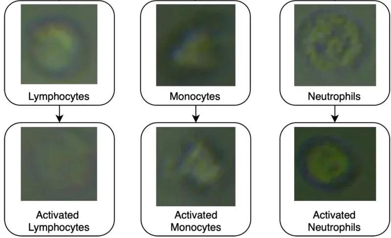 The AI system was trained to recognise both the type of white blood cell (lymphocyte, monocyte or neutrophil) and whether it was in an activated state (responding to infection) or not