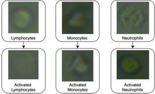 The AI system was trained to recognise both the type of white blood cell (lymphocyte, monocyte or neutrophil) and whether it was in an activated state (responding to infection) or not